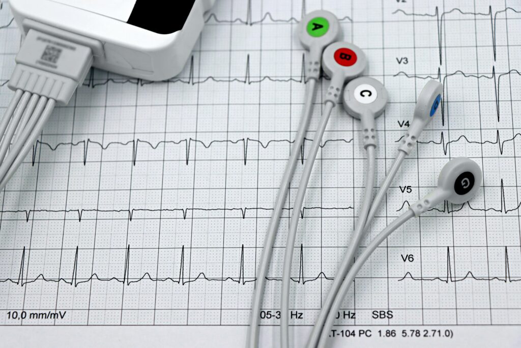 pexels-photo-28585011-28585011 Close-up of ECG monitor leads on a printed cardiogram, showcasing heart health diagnostics.